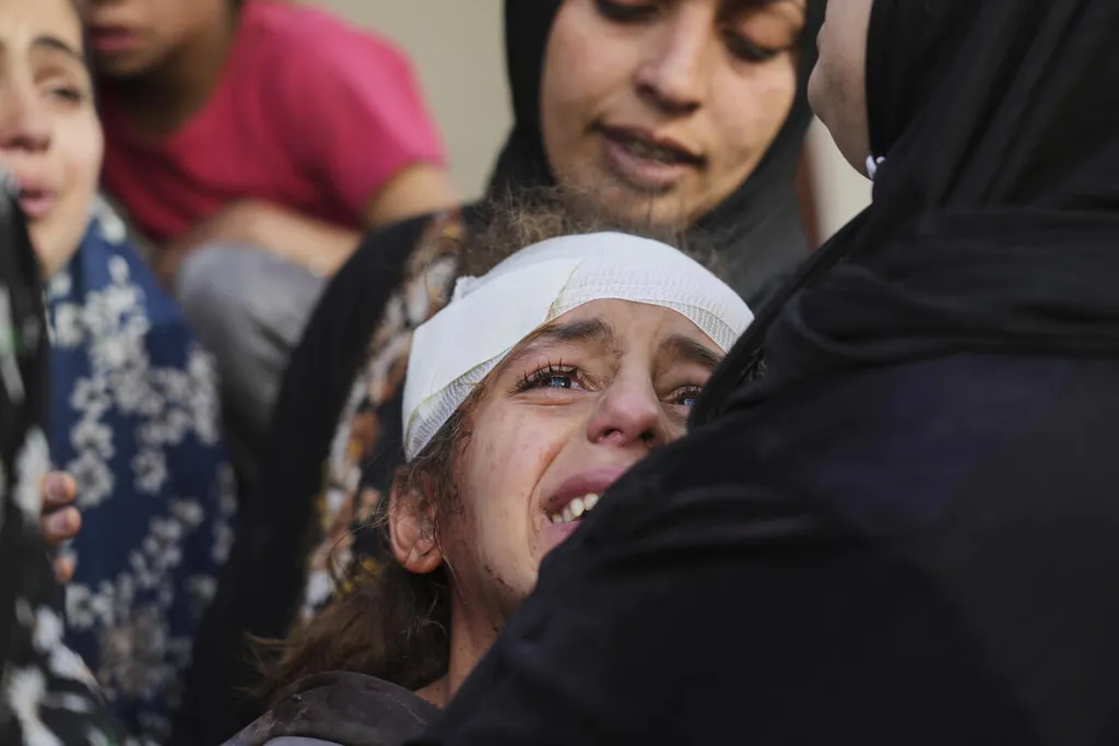 Yamama Jundia, a 13-year-old girl who was injured in an Israeli airstrike, is at the Baptist Hospital in Gaza City on Thursday, April 3, 2025.